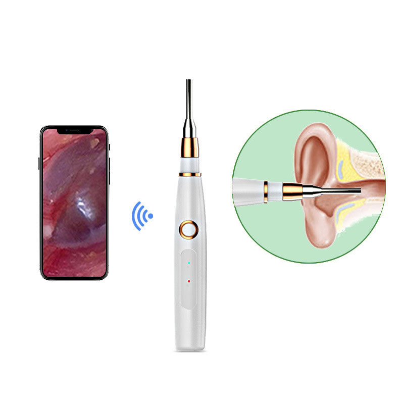 wireless otoscope